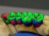 Coloranti fluorescenti pentru ceramica