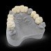 Dental Model Light Grey 0.5 kg