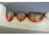 Ceara de lipit 60g