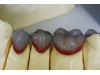 Ceara de lipit 60g
